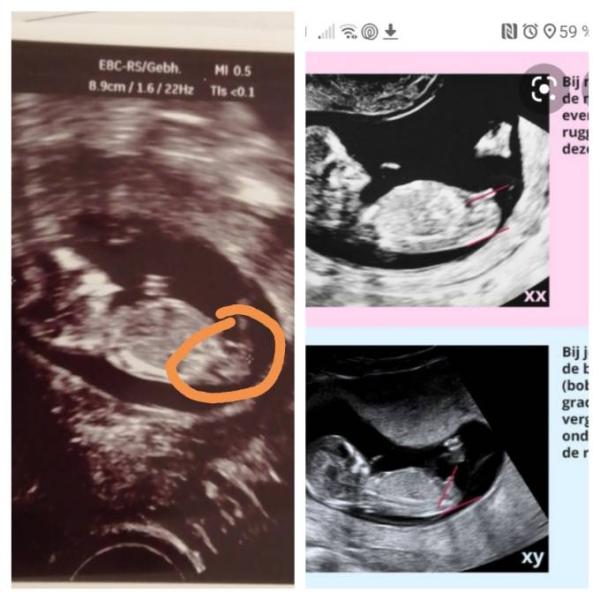 Bild zu Kennt sich jemand mit der nub Theorie aus? - Forum für Januar - Mamis