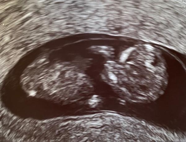 Bild zu Termin Heute - Forum für Januar - Mamis