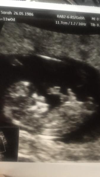 Bild zu 12. Woche, glücklich & Termin gehabt - Forum für Januar - Mamis