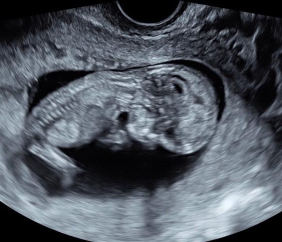 Bild zu Auch meine Testergebnisse sind da - Forum für Januar - Mamis