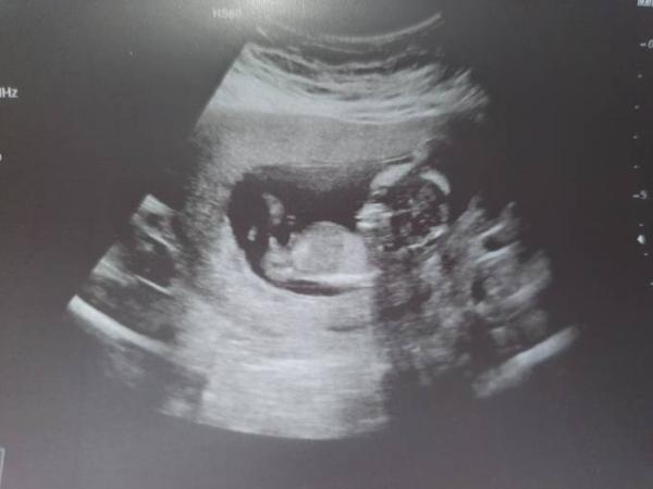 Bild zu Termin heute - Forum für Januar - Mamis
