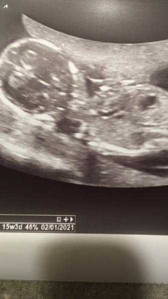 Bild zu 🥰 verliebt vom FA zurück 🥰 - Forum für Januar - Mamis
