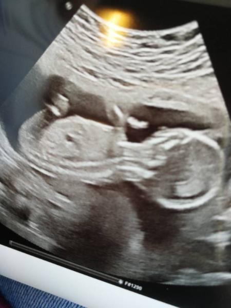 Bild zu US Termin mit Tendenz - Forum für Januar - Mamis