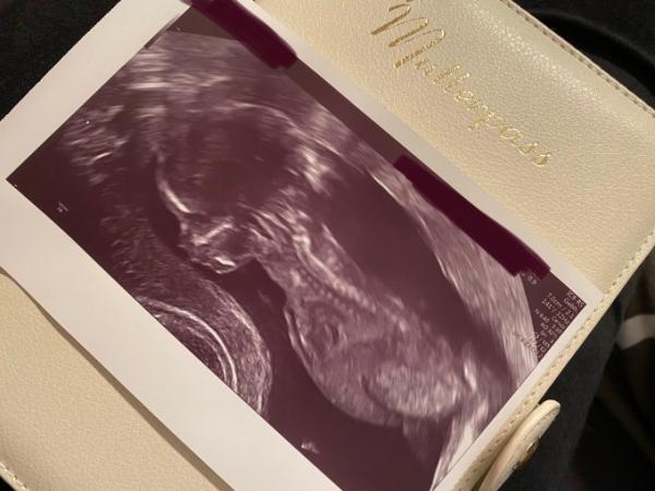 Bild zu Termin Heute - Forum für Januar - Mamis