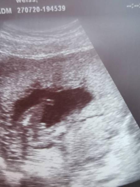 Bild zu Drohender Abort Diagnose - Forum für Januar - Mamis