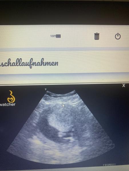 Bild zu Mädchen oder Junge? - Forum für Januar - Mamis