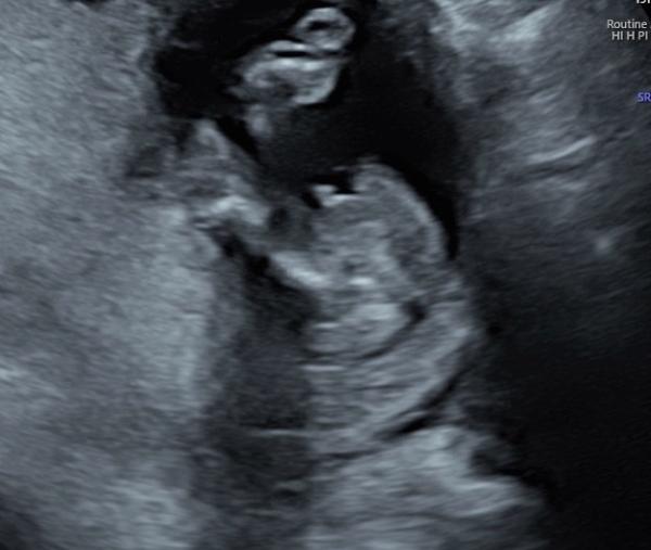Bild zu Mädchen oder Junge? - Forum für Januar - Mamis
