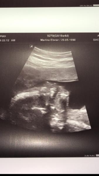 Bild zu Heutiger FA Termin / 2 Screening - Forum für Januar - Mamis