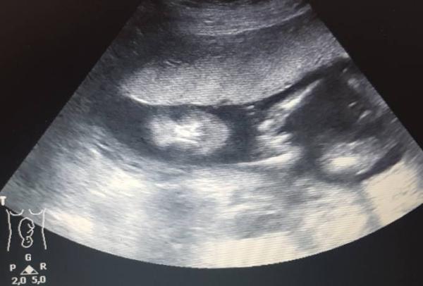 Bild zu Junge oder Mädchen/Mädchen oder Junge? :-) - Forum für Januar - Mamis