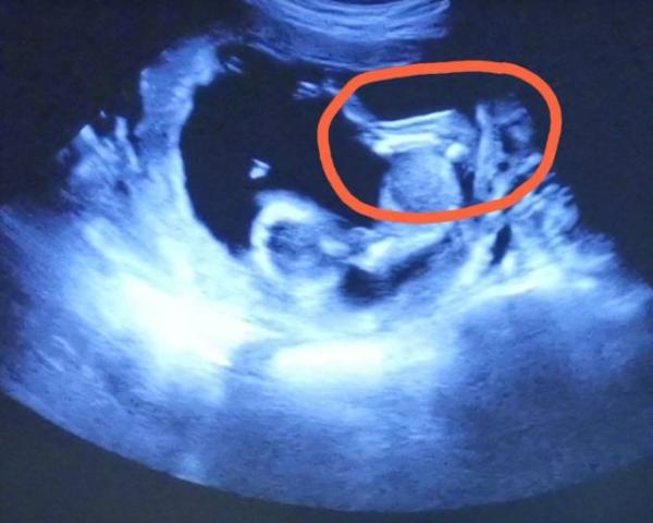 Bild zu Adleraugen aufgepasst 😊 - Forum für Januar - Mamis