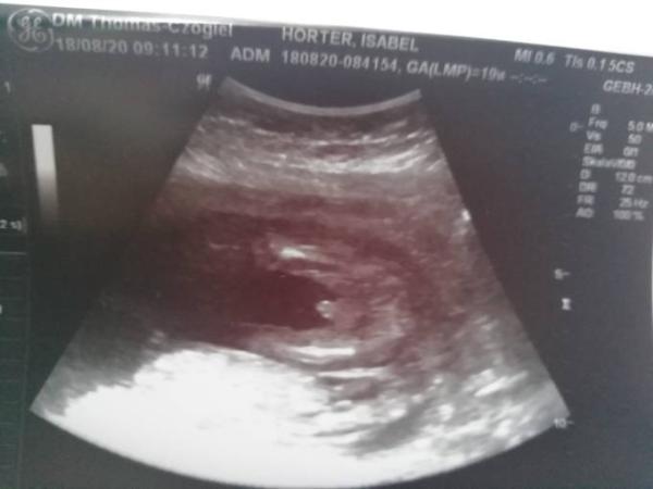 Bild zu 2. US und Outing - Forum für Januar - Mamis