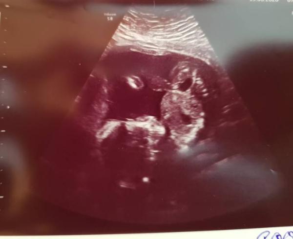 Bild zu Mädchen oder Junge? - Forum für Januar - Mamis