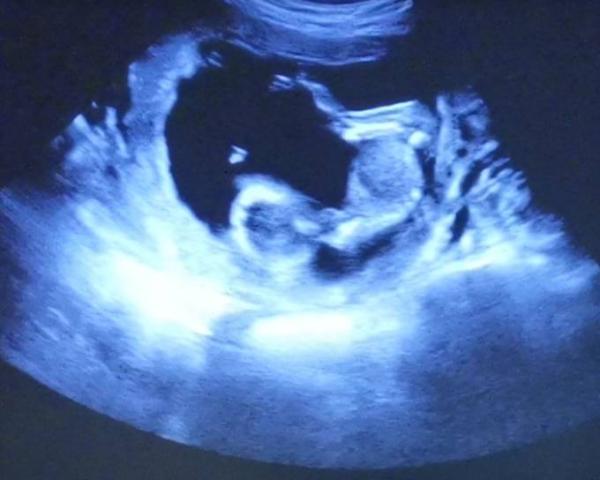 Bild zu Träume - Forum für Januar - Mamis