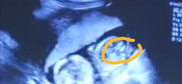 Bild zu Junge oder Mädchen?🤔 - Forum für Januar - Mamis