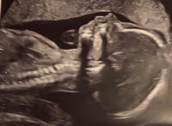 Bild zu 2. großer US - Forum für Januar - Mamis