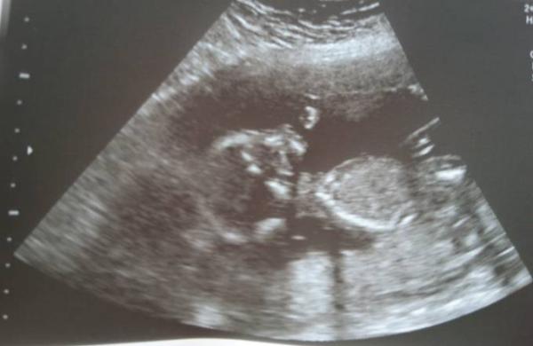 Bild zu Kein Bock auf Outing... đ - Forum fĂŒr Januar - Mamis