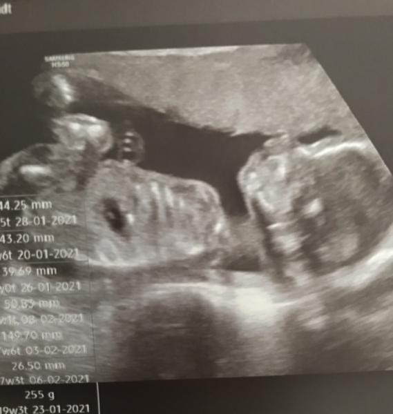 Bild zu 2. US - Forum für Januar - Mamis