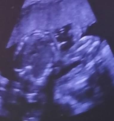 Bild zu Bild, das ist doch der kleine wutzi oder đ? - Forum fĂŒr Januar - Mamis