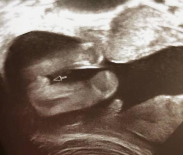 Bild zu Zurück vom Fa 😍 - Forum für Januar - Mamis