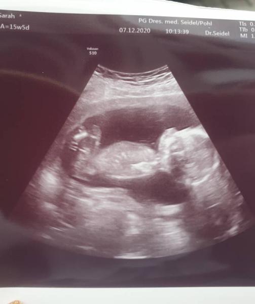 Bild zu Wir wissen endlich das Geschlecht - Forum für Januar - Mamis