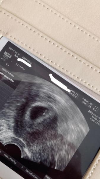 Bild zu Ängste nach Termin - Forum für Januar - Mamis