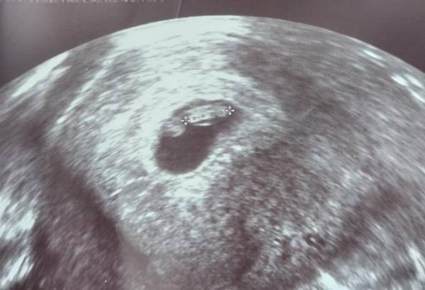 Bild zu Erster US - Forum für Januar - Mamis