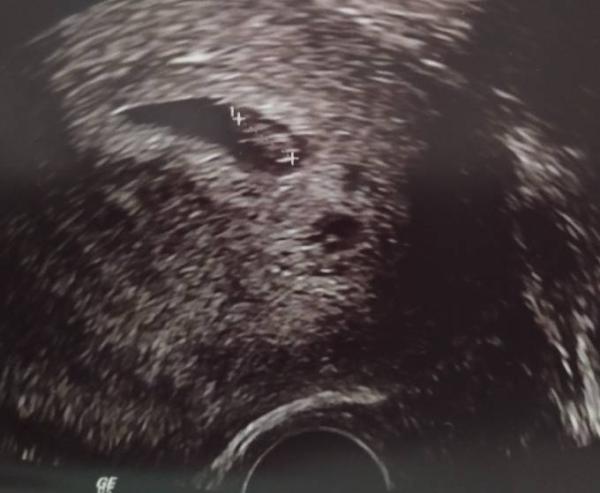 Bild zu Der Januar ist auch unser Monat - Forum für Januar - Mamis