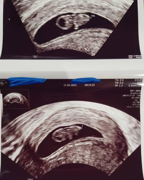 Bild zu Hallo ihr Lieben 🙋‍♀️ - Forum für Januar - Mamis