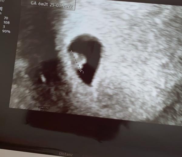 Bild zu Hallöle - Forum für Januar - Mamis