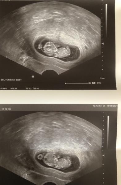 Bild zu Unsicher - Forum für Januar - Mamis