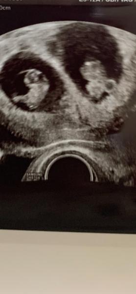 Bild zu Zwilling hat aufgeholt - Forum für Januar - Mamis