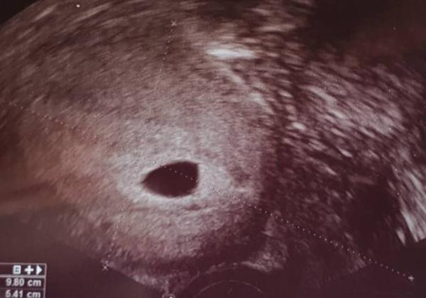 Bild zu Wie es jetzt weiter geht - Forum für Januar - Mamis
