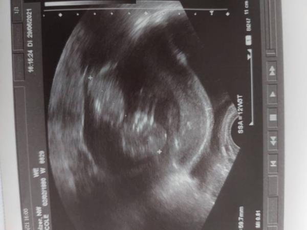 Bild zu Hallo zweites Trimester - Forum für Januar - Mamis