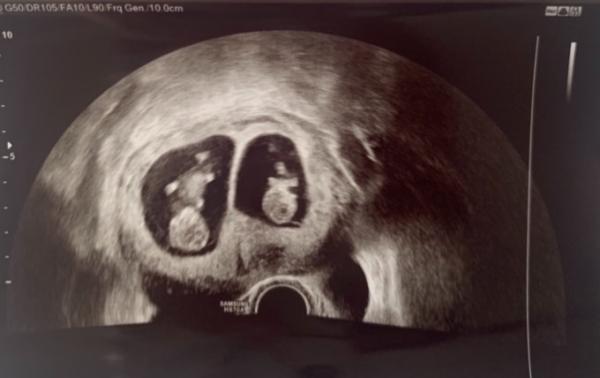 Bild zu Nächstes Update :) - Forum für Januar - Mamis
