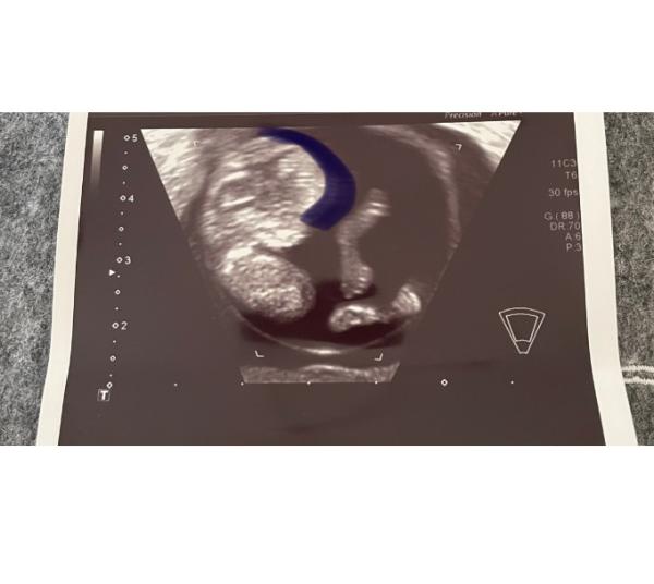 Bild zu Könnt ihr was sehen ? ❤️💙 - Forum für Januar - Mamis