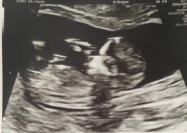 Bild zu Baby Tv 😍 - Forum für Januar - Mamis