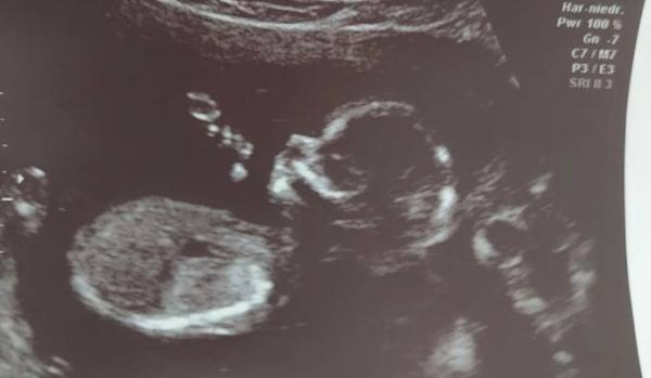 Bild zu Sono Termin - Forum für Januar - Mamis