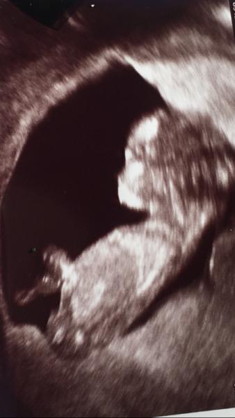 Bild zu ♥️ Oder 💙 - Forum für Januar - Mamis