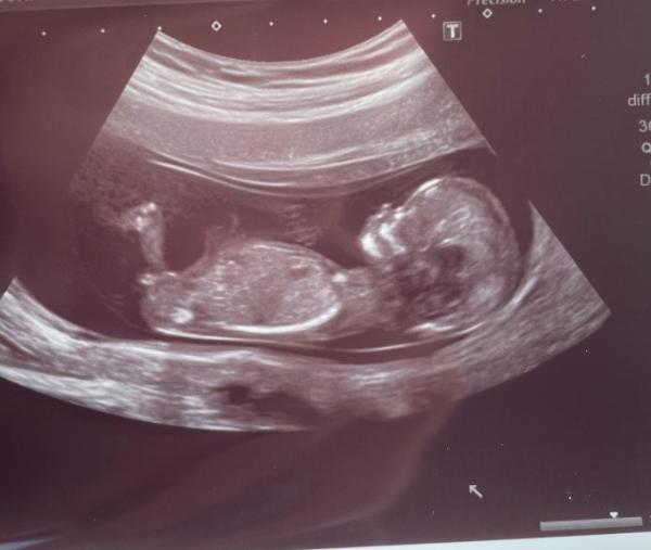 Bild zu 💙oder ❤️ - Forum für Januar - Mamis