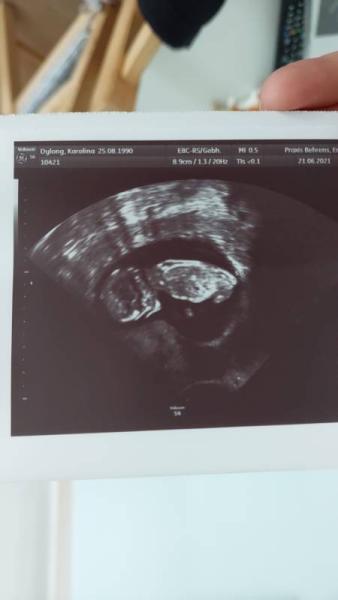 Bild zu Mädchen oder Junge? - Forum für Januar - Mamis