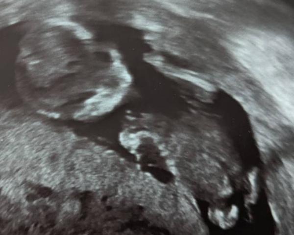 Bild zu Ein Junge ? - Forum für Januar - Mamis