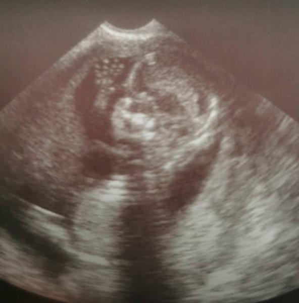 Bild zu FA Termin - Forum für Januar - Mamis