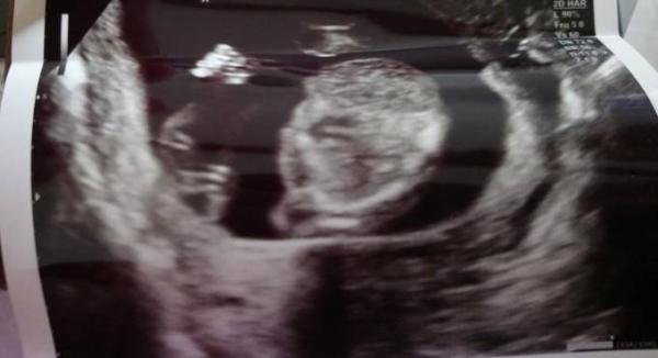 Bild zu Us-Foto - Forum für Januar - Mamis