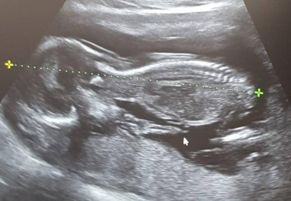 Bild zu Baby zu dünn?? - Forum für Januar - Mamis