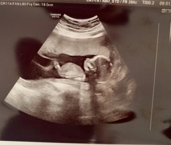 Bild zu Nächstes update - Forum für Januar - Mamis