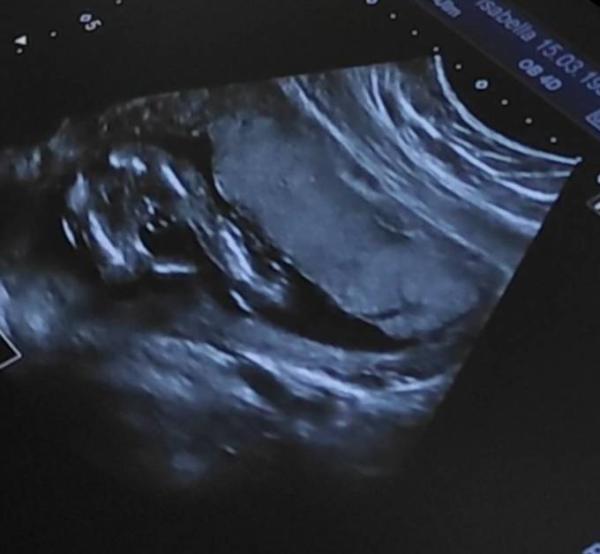 Bild zu 19 SSW Geschlecht unklar - Forum für Januar - Mamis