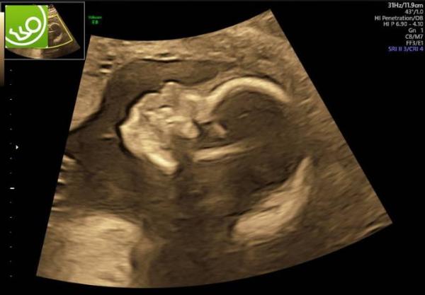 Bild zu Darf ich zu euch - Forum für Januar - Mamis