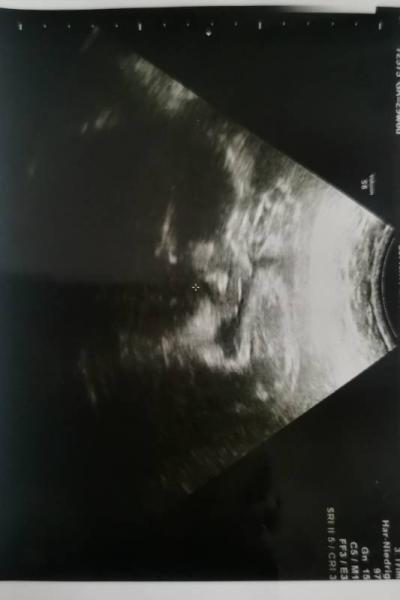 Bild zu Lage des Babys đ€ - Forum fĂŒr Januar - Mamis