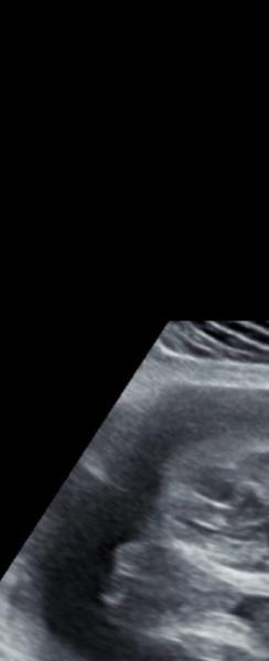 Bild zu Kurze frage - Forum für Januar - Mamis