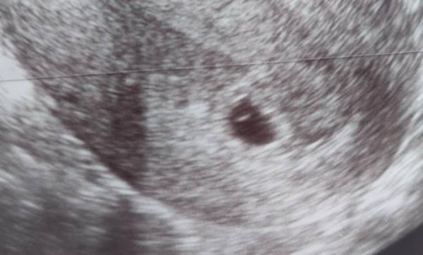 Bild zu 6ssw - Forum für Januar - Mamis